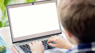 Waspada Bahaya Pangku Laptop, Bisa Picu Masalah Kulit